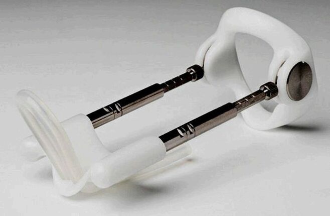 阴茎增大延长器