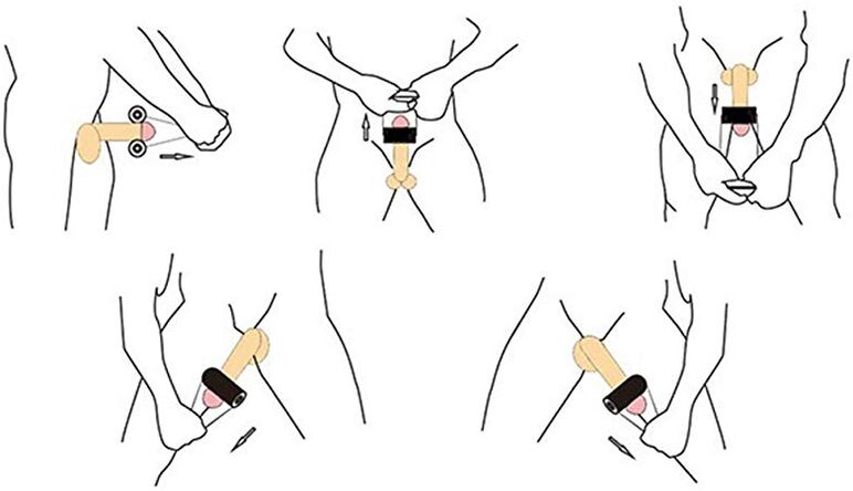 Jelching是一种用于阴茎自我增大的按摩技术。
